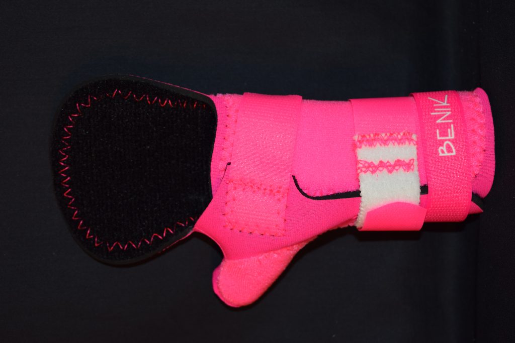 Custom Wrist Splint